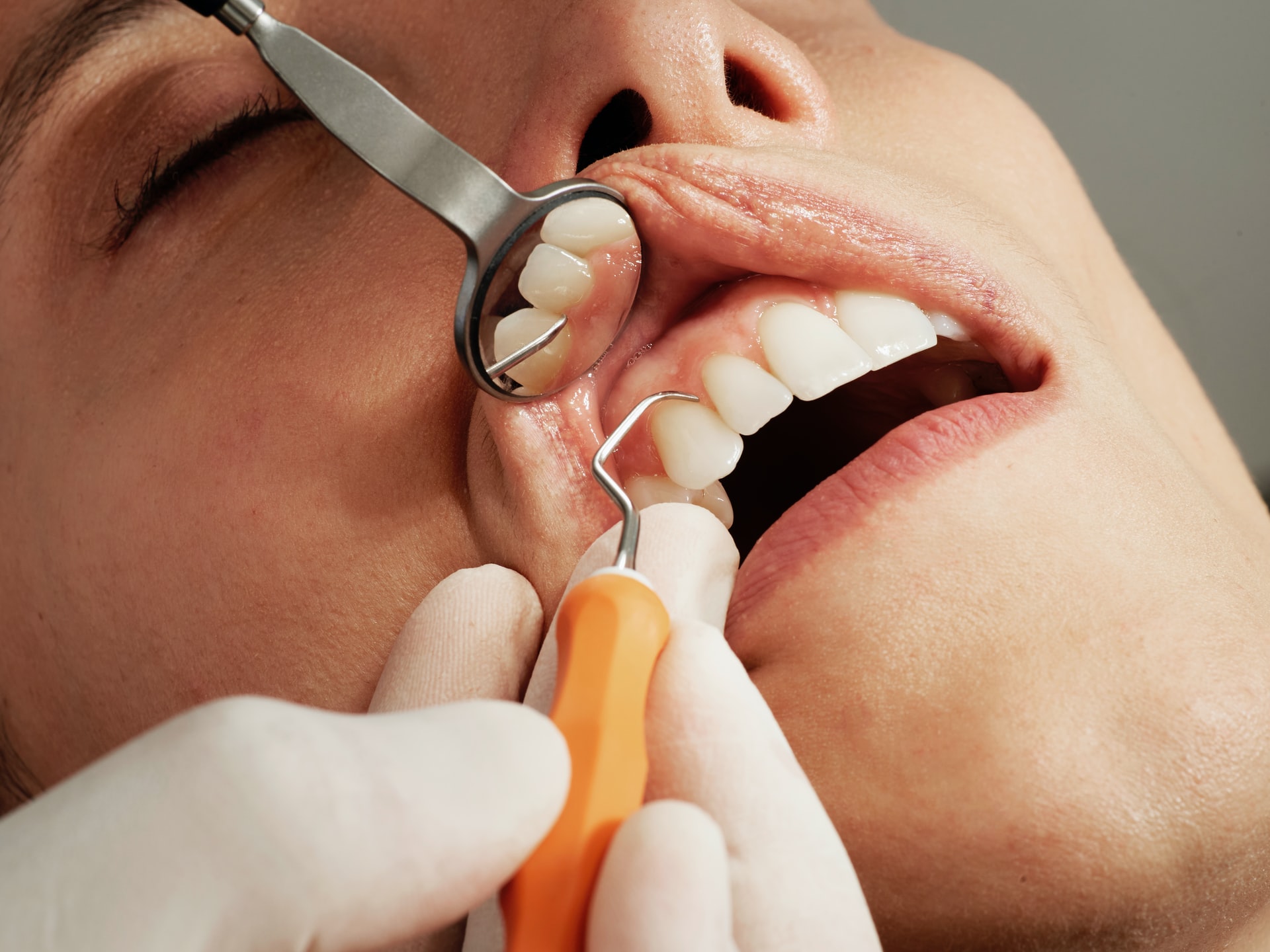 Cara Mengatasi dan Menghilangkan Bau Mulut penghilang