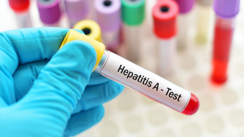 cara mencegah hepatitis