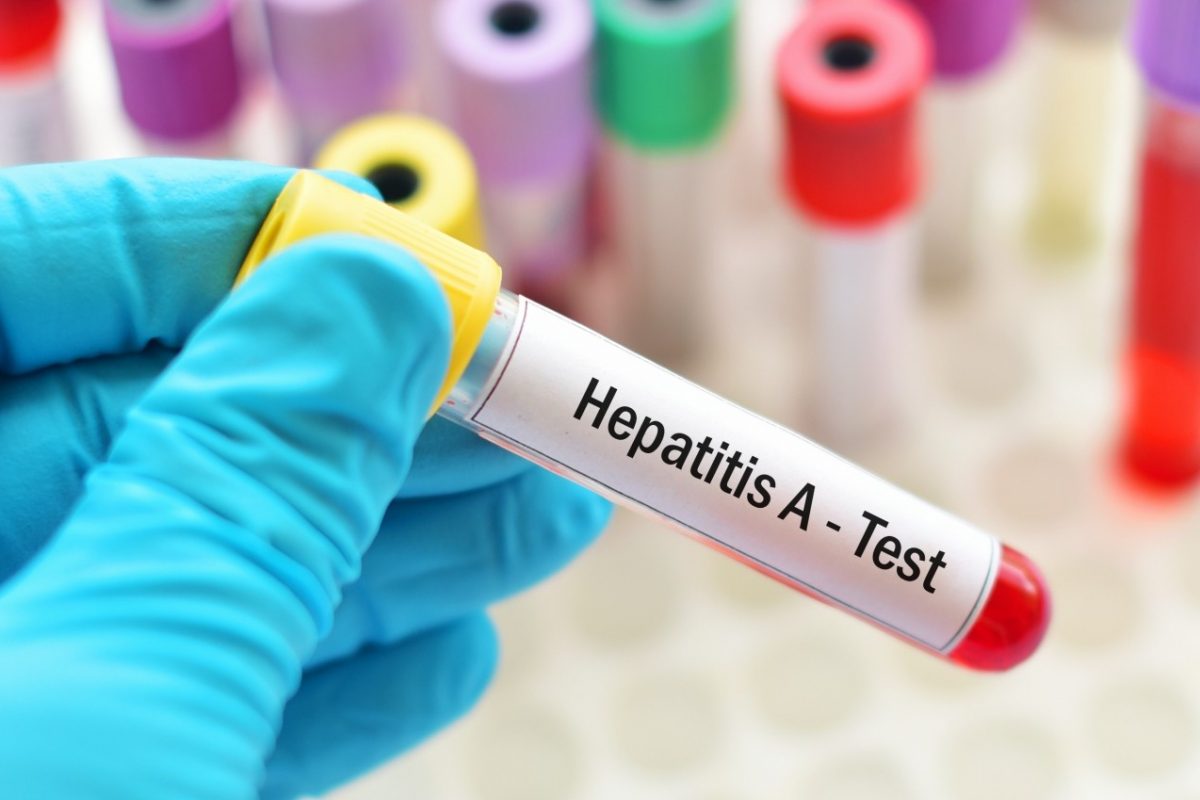 cara mencegah hepatitis