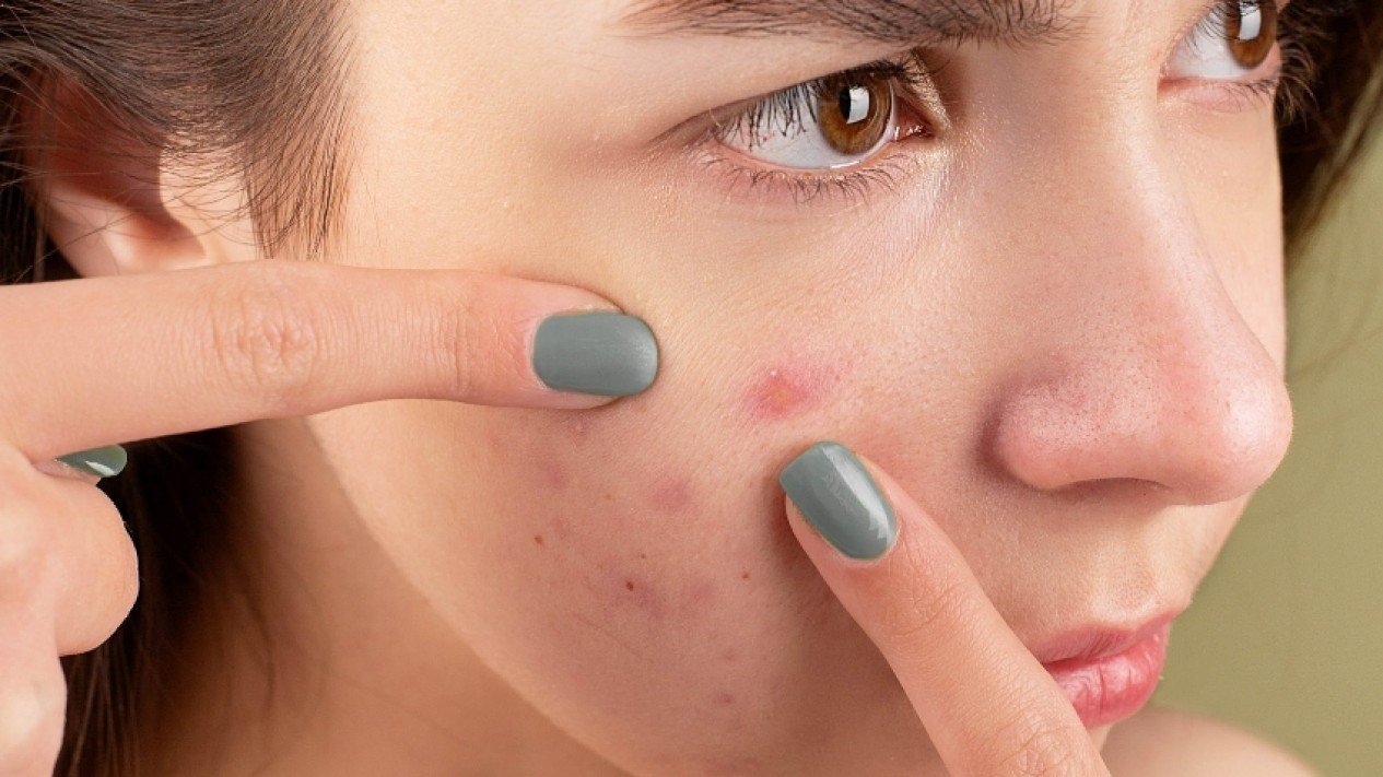 Ciri-ciri muka alergi kosmetik