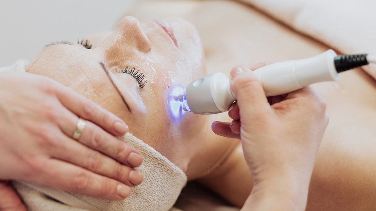 Laser atau Chemical Peeling