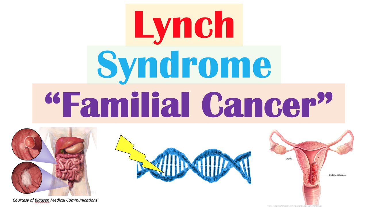 Lynch syndrome